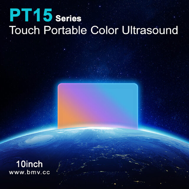 PulseTouch™PT15 EXP 10inch Touch Color Doppler Point-of-Care Imaging Ultrasound System