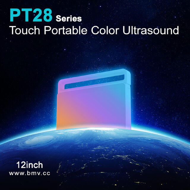 PulseTouch™PT28 12inch Touch Color Doppler Point-of-Care Imaging Ultrasound System